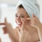 Acne Scars 85x85