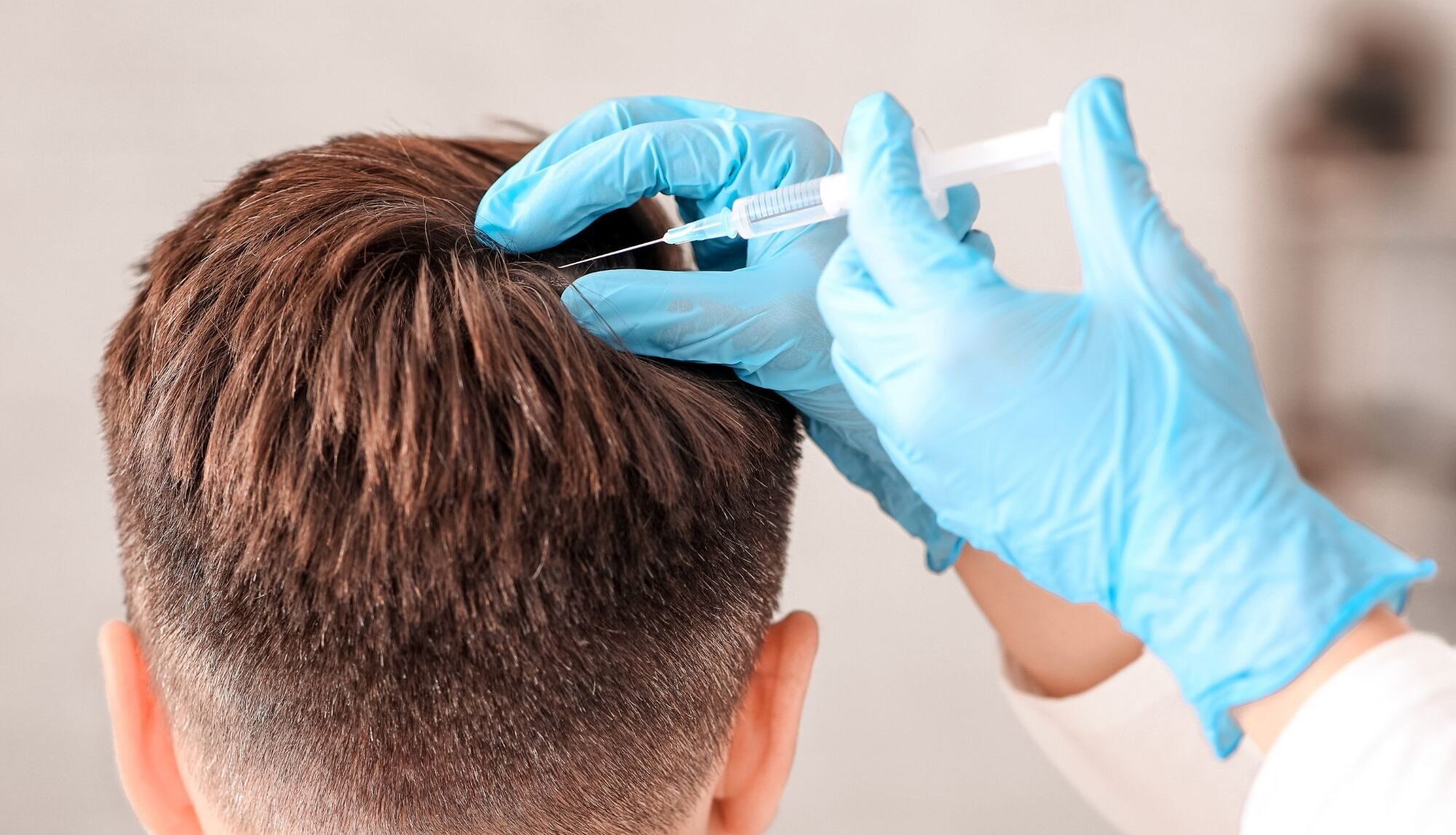 Hair Stem Cell Therapy 1 e1780581093561