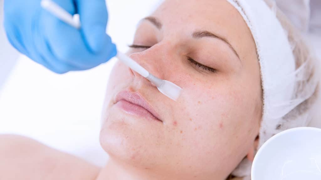 Open Pores Treatment 1