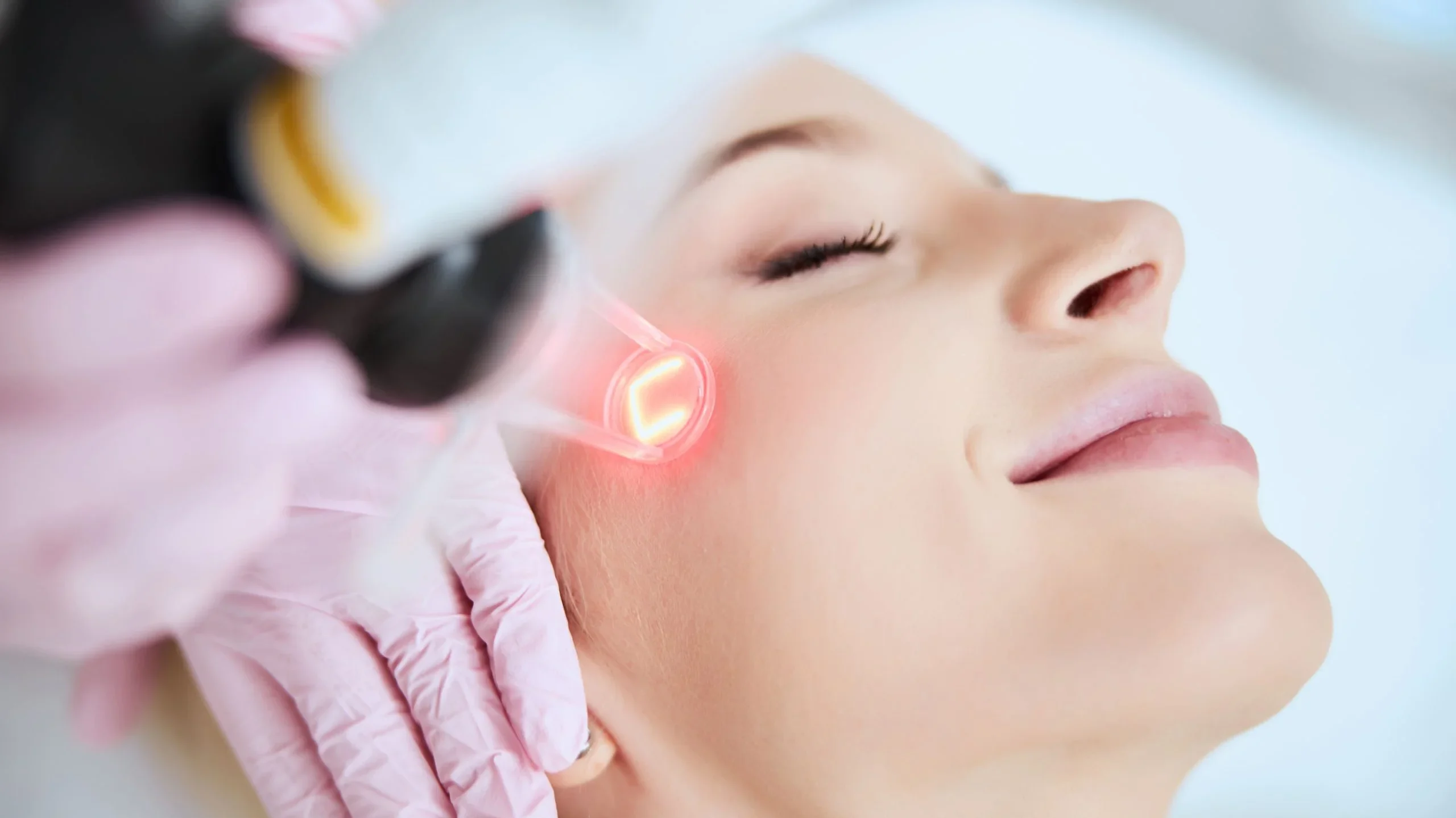 Pico Laser Therapy e1781959513617