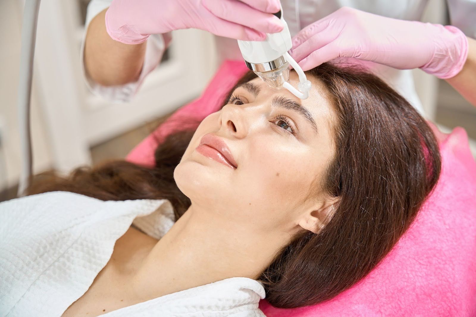 RF Microneedling 1