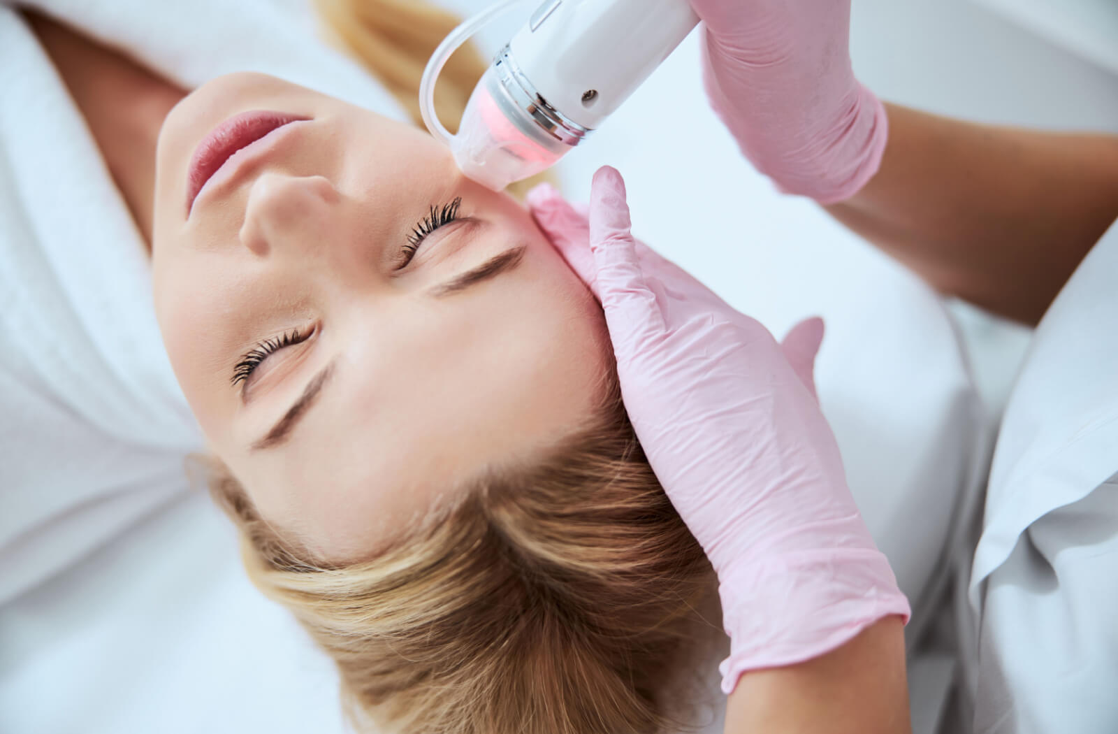 RF Microneedling 2
